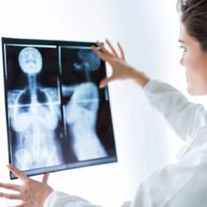 doctor looking at the Mammogram film image